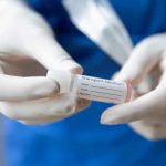 Петима от Витоша Бистрица с коронавирус