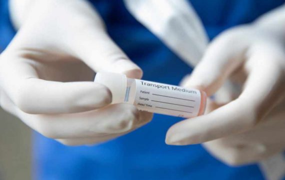 Петима от Витоша Бистрица с коронавирус